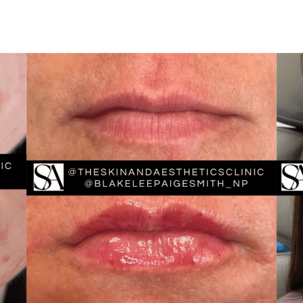 Beautiful before and after cosmetic enhancement in Upper Cumberland.
